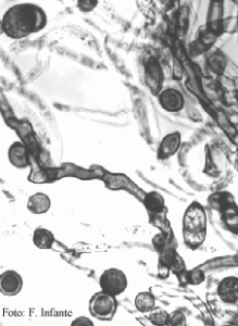 Cladosporium cladosporioides (M.O.).